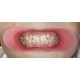   VisionButler Pink  Medium Dental Retractor