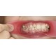    VisionButler Pink Small Dental Retractor