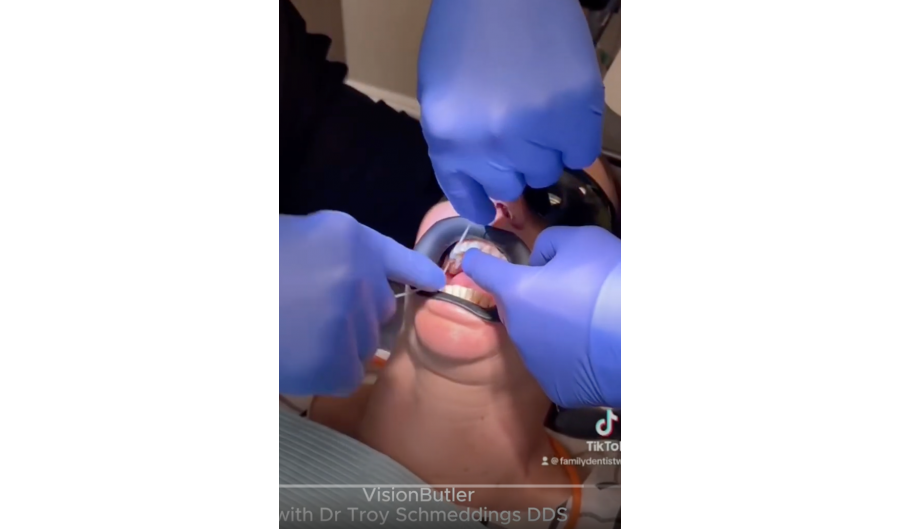 Dr Troy Schmedding DDS showing VisionButler and Laminatebutler