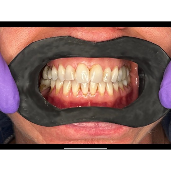 VisionButler- Medium- NEW VisionButler- Medium- NEW