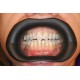  VisionButler- Medium- Dental retractor