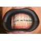 VisionButler- Medium- Dental retractor