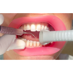   VisionButler Pink  Medium Dental retractor