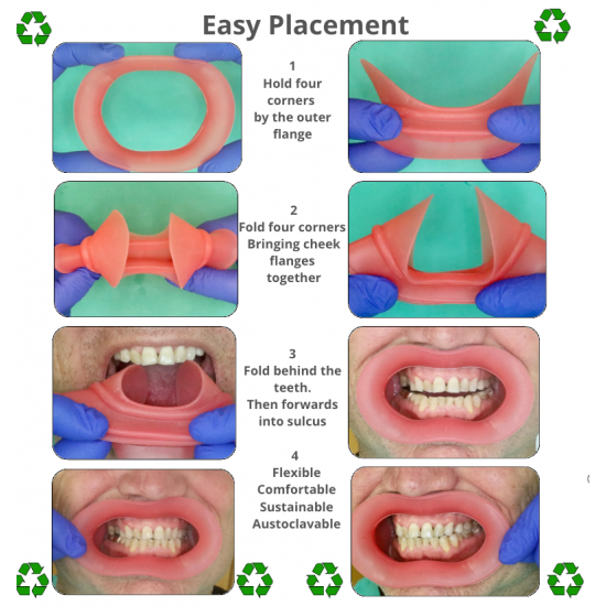    VisionButler Pink Small Dental Retractor