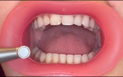 Peace of Mind. VisionButler 