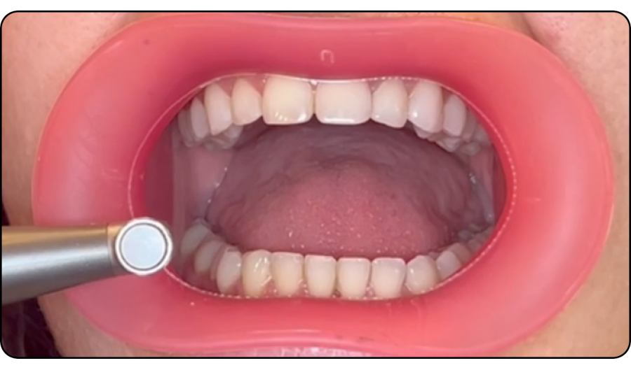 Peace of Mind. VisionButler 