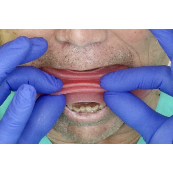  VisionButler PINK Combo Large Medium Small
