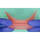   VisionButler Pink Large Dental retractor