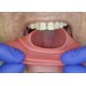   VisionButler Pink Large Dental retractor