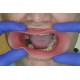   VisionButler Pink Large Dental retractor