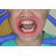   VisionButler Pink Large Dental retractor