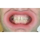   VisionButler Pink Large Dental retractor