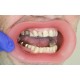   VisionButler Pink Large Dental retractor