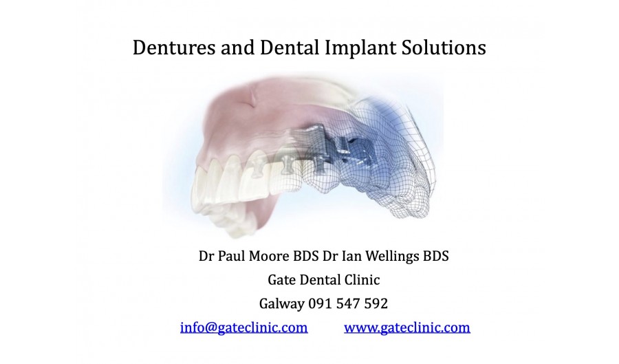 Implant and denture solutions